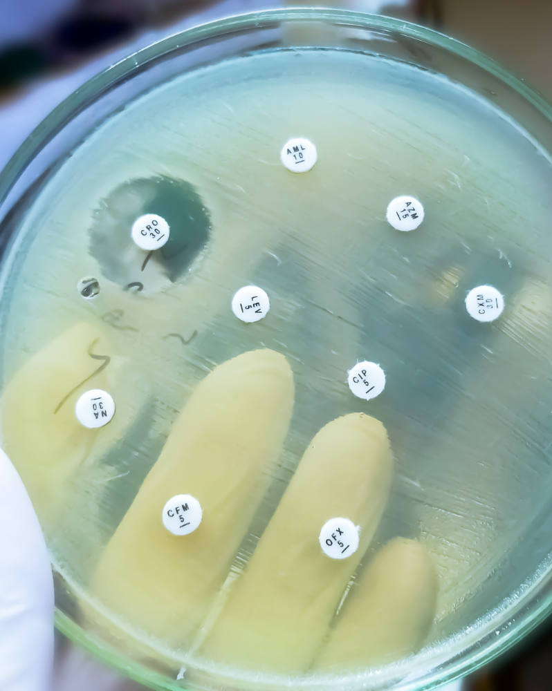 Antimicrobial susceptibility testing in petri dish