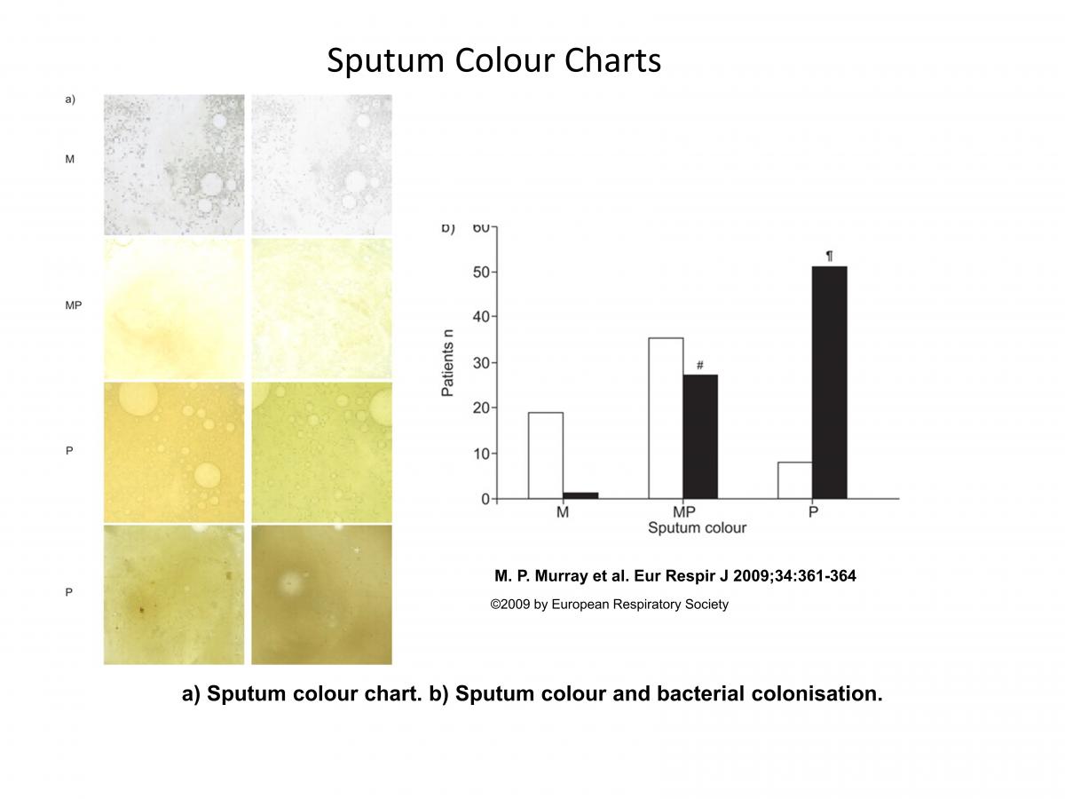 sputum_colour_chart